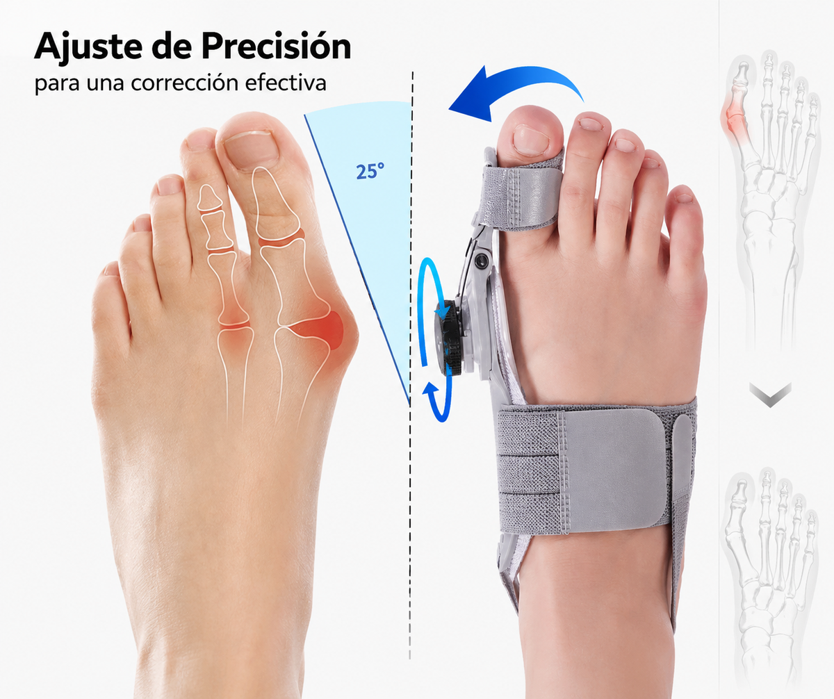 Plenia Fee - Corrector ortopédico de juanetes | 1+1 GRATIS