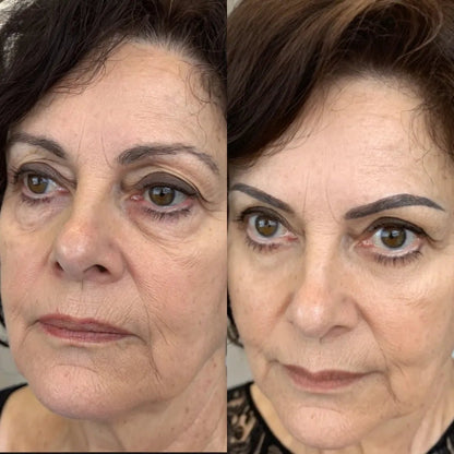 Plenia Eye 2 en 1: Terapia de Luz Roja para eliminar las bolsas de los ojos